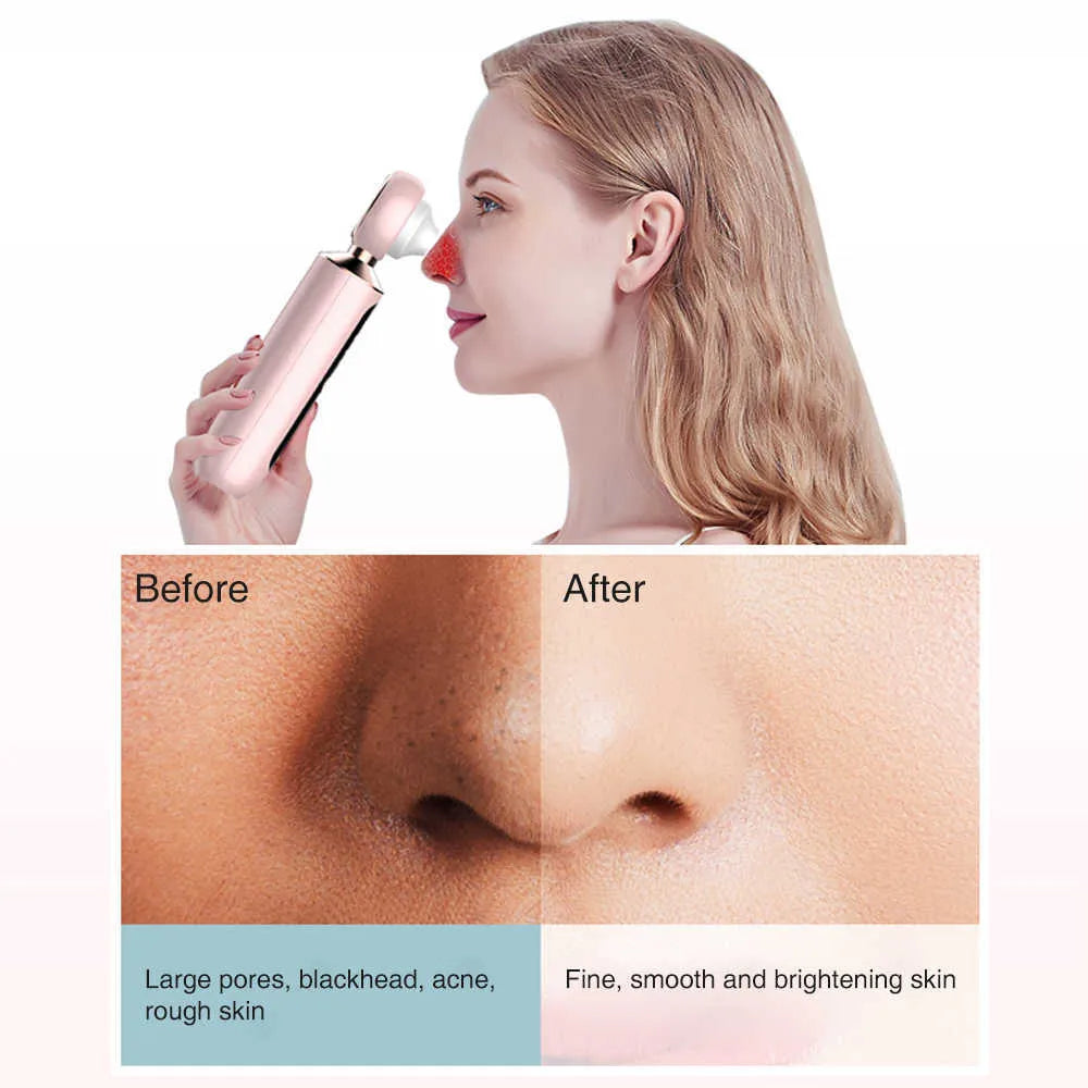 Zayna™ Blackhead Suction Machine