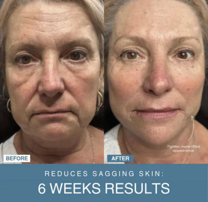 Zayna™ 7-in-1 LED Anti-Aging/Wrinkle Apparatus